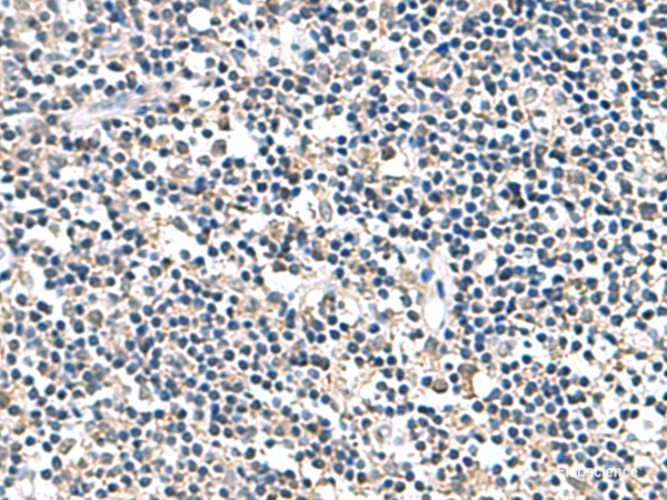 Immunohistochemistry of paraffin-embedded Human tonsil tissue using ATP5F1D Polyclonal Antibody at dilution of 1:80(×200)