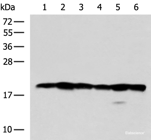 Western blot analysis of 293T Jurkat Hela and 231 cell lysates using BLOC1S6 Polyclonal Antibody at dilution of 1:600