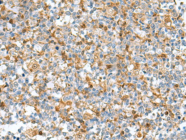 Immunohistochemistry of paraffin-embedded Human tonsil tissue using DNPH1 Polyclonal Antibody at dilution of 1:55(×200)