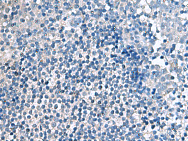 Immunohistochemistry of paraffin-embedded Human tonsil tissue using EIF4A2 Polyclonal Antibody at dilution of 1:70(×200)