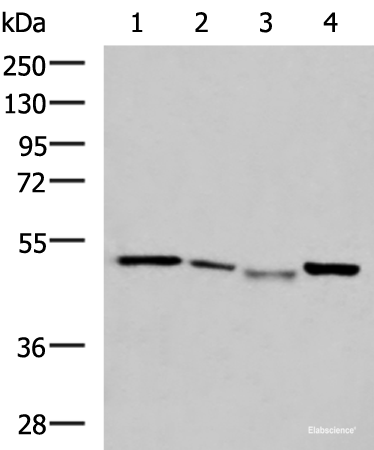 Western blot analysis of HepG2 cell Hela cell Mouse kidney tissue K562 cell lysates using NFS1 Polyclonal Antibody at dilution of 1:800