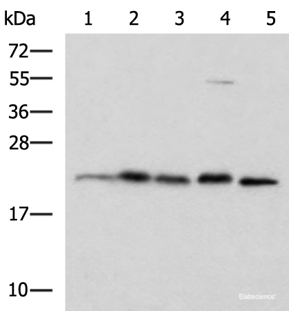 Western blot analysis of A172 HepG2 Hela cell Rat brain tissue and Mouse brain tissue lysates using HPCAL1 Polyclonal Antibody at dilution of 1:1250