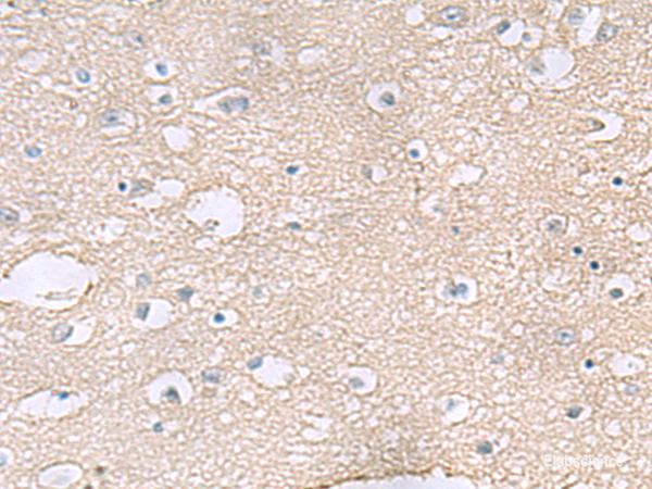 Immunohistochemistry of paraffin-embedded Human brain tissue using TAGLN3 Polyclonal Antibody at dilution of 1:60(×200)
