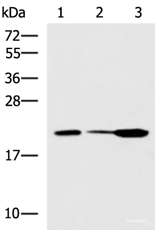 Western blot analysis of Mouse small intestines tissue Mouse kidney tissue Mouse pancreas tissue lysates using PPIC Polyclonal Antibody at dilution of 1:550