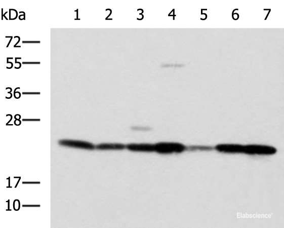 Western blot analysis of SKOV3 Hela cell Mouse liver tissue Mouse heart tissue Human placenta tissue HepG2 cell Human heart tissue lysates using ATP5O Polyclonal Antibody at dilution of 1:1250