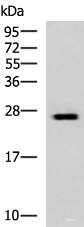 Western blot analysis of Hela cell lysate using GINS3 Polyclonal Antibody at dilution of 1:800