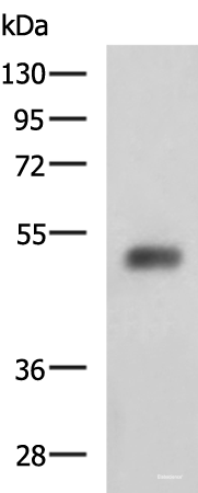 Western blot analysis of Human bladder transitional cell carcinoma grade 2-3 tissue lysate using SLC30A6 Polyclonal Antibody at dilution of 1:2000