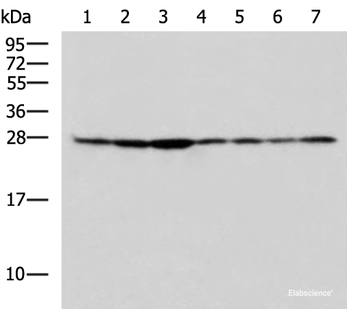Western blot analysis of HepG2 Hela Jurkat HUVEC cell Mouse lung tissue Mouse kidney tissue Rat liver tissue lysates using RPL10A Polyclonal Antibody at dilution of 1:700