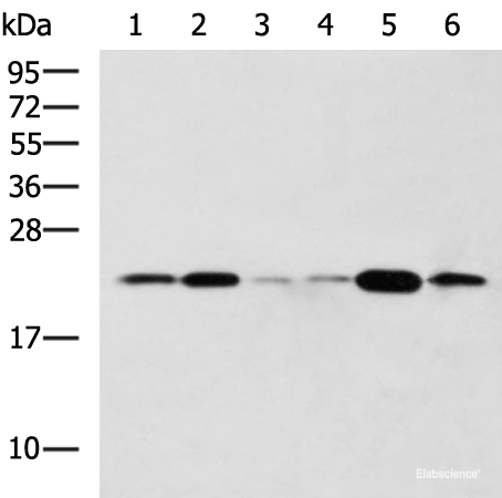 Western blot analysis of Raji Hela cell Mouse liver tissue Rat lung tissue Mouse Pancreas tissue NIH/3T3 cell lysates using TMED10 Polyclonal Antibody at dilution of 1:800