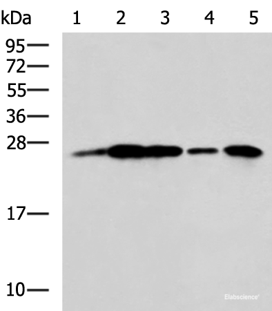 Western blot analysis of A549 cell Rat brain tissue Mouse brain tissue A172 cell Human cerebrum tissue lysates using UCHL1 Polyclonal Antibody at dilution of 1:800