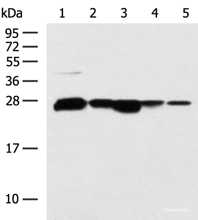 Western blot analysis of 293T HepG2 cell Human fetal liver tissue Human liver tissue TM4 cell lysates using CCDC134 Polyclonal Antibody at dilution of 1:800