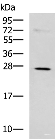 Western blot analysis of K562 cell lysate using NQO2 Polyclonal Antibody at dilution of 1:650