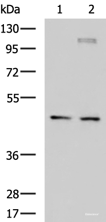 Western blot analysis of Jurkat and TM4 cell lysates using DNAJA4 Polyclonal Antibody at dilution of 1:650
