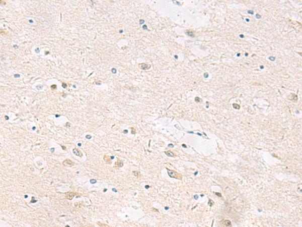 Immunohistochemistry of paraffin-embedded Human brain tissue using ANKS6 Polyclonal Antibody at dilution of 1:55(×200)