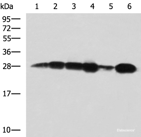 Western blot analysis of 293T cell Human bladder transitional cell carcinoma grade 2-3 tissue lysate MCF-7 cell lysates using MMAB Polyclonal Antibody at dilution of 1:1400