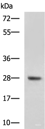 Western blot analysis of Mouse liver tissue lysate using DHRS2 Polyclonal Antibody at dilution of 1:800