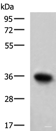 Western blot analysis of Mouse skeletal muscle tissue lysate using TNNT1 Polyclonal Antibody at dilution of 1:550