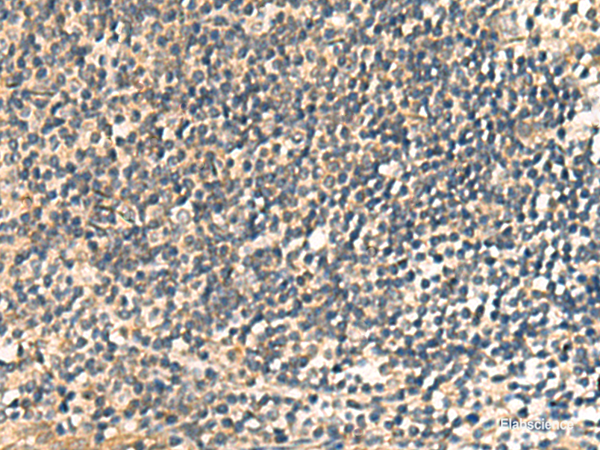 Immunohistochemistry of paraffin-embedded Human tonsil tissue using CNST Polyclonal Antibody at dilution of 1:60(×200)