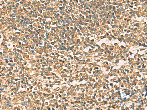 Immunohistochemistry of paraffin-embedded Human tonsil tissue using THG1L Polyclonal Antibody at dilution of 1:50(×200)
