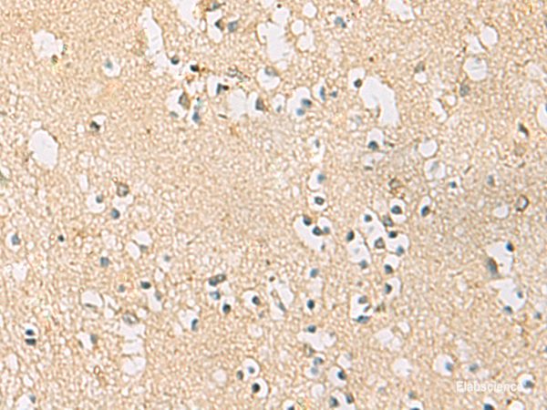 Immunohistochemistry of paraffin-embedded Human brain tissue using PDE4DIP Polyclonal Antibody at dilution of 1:45(×200)