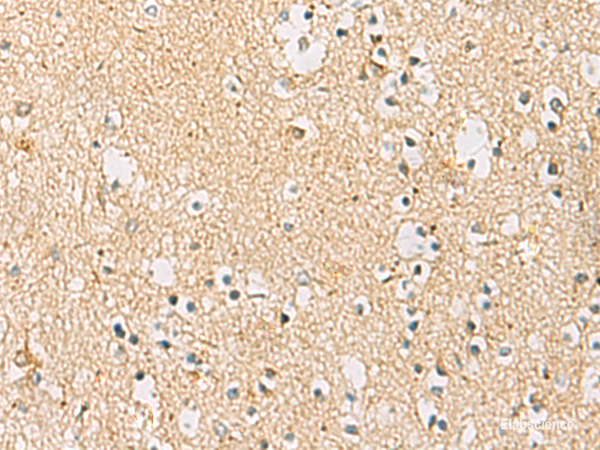 Immunohistochemistry of paraffin-embedded Human brain tissue using IDS Polyclonal Antibody at dilution of 1:70(×200)