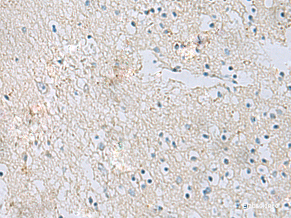 Immunohistochemistry of paraffin-embedded Human brain tissue using RDH5 Polyclonal Antibody at dilution of 1:50(×200)