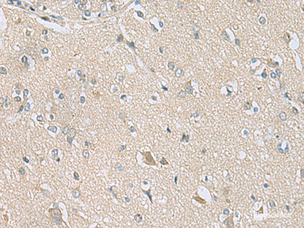 Immunohistochemistry of paraffin-embedded Human brain tissue using TSTA3 Polyclonal Antibody at dilution of 1:80(×200)