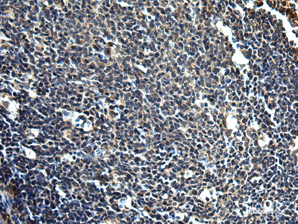 Immunohistochemistry of paraffin-embedded Human tonsil tissue using PRRT2 Polyclonal Antibody at dilution of 1:50(×200)