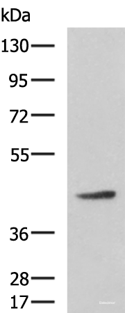 Western blot analysis of Hela cell lysate using ARPC1B Polyclonal Antibody at dilution of 1:800