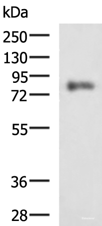 Western blot analysis of HepG2 cell lysate using PRKCSH Polyclonal Antibody at dilution of 1:1350