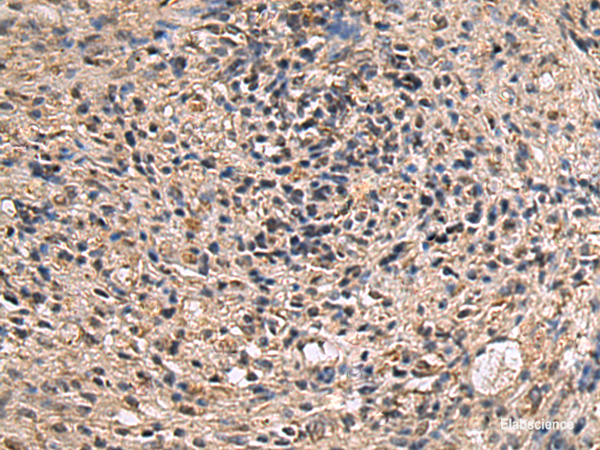 Immunohistochemistry of paraffin-embedded Human brain tissue using ITIH2 Polyclonal Antibody at dilution of 1:70(×200)