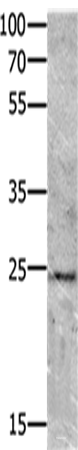 Western blot analysis of Mouse brain tissue using VEGFB Polyclonal Antibody at dilution of 1:700