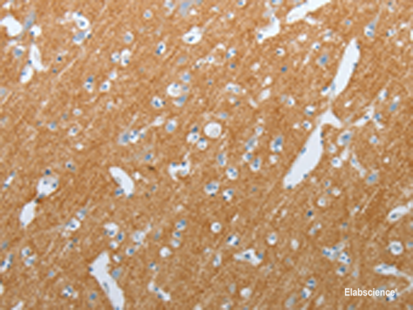 Immunohistochemistry of paraffin-embedded Human brain tissue using SLC17A7 Polyclonal Antibody at dilution of 1:200(×200)