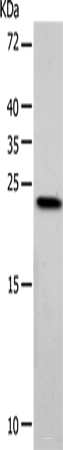 Western blot analysis of Hela cells using VSNL1 Polyclonal Antibody at dilution of 1:900
