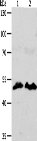 Western blot analysis of HT29 cells hela cells using ZWILCH Polyclonal Antibody at dilution of 1:1750