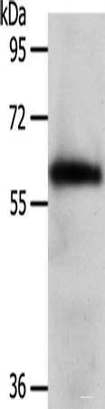 Western blot analysis of Mouse brain tissue using WDR1 Polyclonal Antibody at dilution of 1:1000