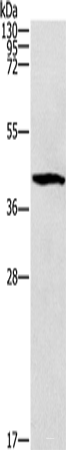 Western blot analysis of Mouse brain tissue using ZADH2 Polyclonal Antibody at dilution of 1:1000