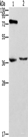 Western blot analysis of Jurkat cells mouse thymus tissue using ZAP70 Polyclonal Antibody at dilution of 1:1000