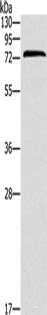 Western blot analysis of Jurkat cells using ZAP70 Polyclonal Antibody at dilution of 1:1000