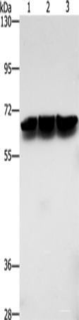 Western blot analysis of Jurkat cells hela cells mouse brain tissue using ZBTB1 Polyclonal Antibody at dilution of 1:500