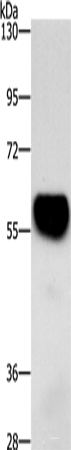 Western blot analysis of Mouse heart tissue using ZBTB26 Polyclonal Antibody at dilution of 1:500