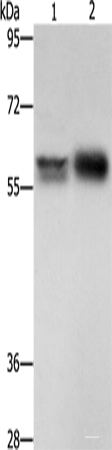 Western blot analysis of Hepg2 cells NIH/3T3 cells using ZBTB7A Polyclonal Antibody at dilution of 1:500