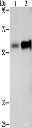 Western blot analysis of Hepg2 cells NIH/3T3 cells using ZBTB7A Polyclonal Antibody at dilution of 1:500