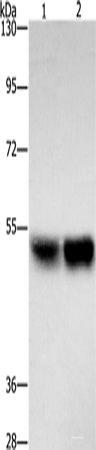 Western blot analysis of Hela cells A431 cells using ZFYVE19 Polyclonal Antibody at dilution of 1:500