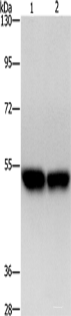 Western blot analysis of Hela cells A431 cells using ZFYVE19 Polyclonal Antibody at dilution of 1:500