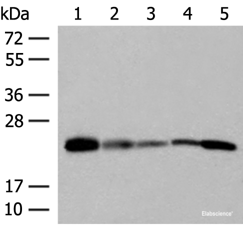 Western blot analysis of 293T 231 HUVEC Hela and A549 cell lysates using MT-CO2 Polyclonal Antibody at dilution of 1:400