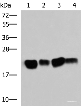 Western blot analysis of Mouse brain tissue SKOV3 cell Rat brain tissue Mouse kidney tissue lysates using HRAS Polyclonal Antibody at dilution of 1:500