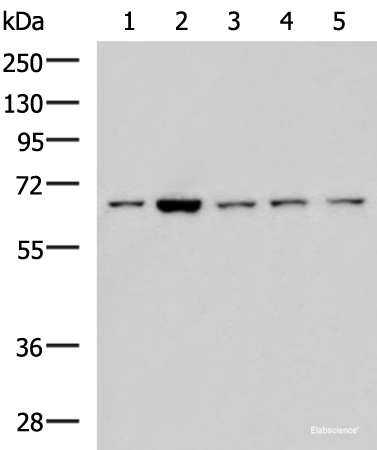 Western blot analysis of 293T LOVO Hela and Jurkat cell lysates using CHEK2 Polyclonal Antibody at dilution of 1:600