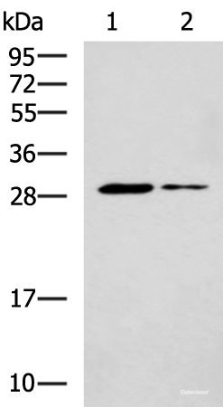 Western blot analysis of Mouse liver tissue and Mouse skeletal muscle tissue lysates using POMC Polyclonal Antibody at dilution of 1:800