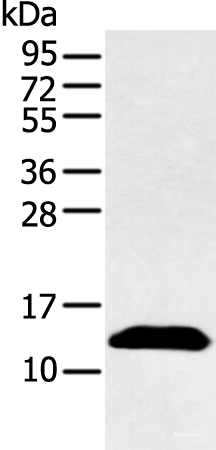 Western blot analysis of Human plasma solution using PPBP Polyclonal Antibody at dilution of 1:500